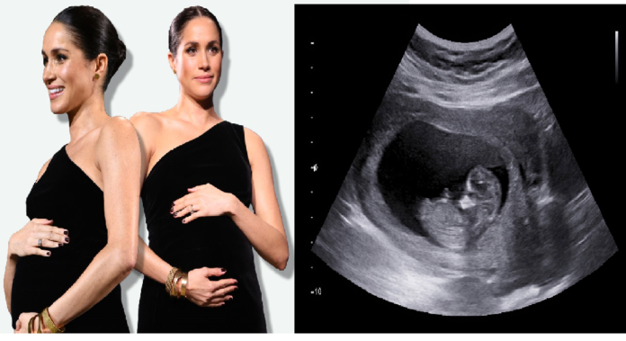 Breaking news : Meghan Markle overjoyed as ultrasound shows she will be having a baby girl
